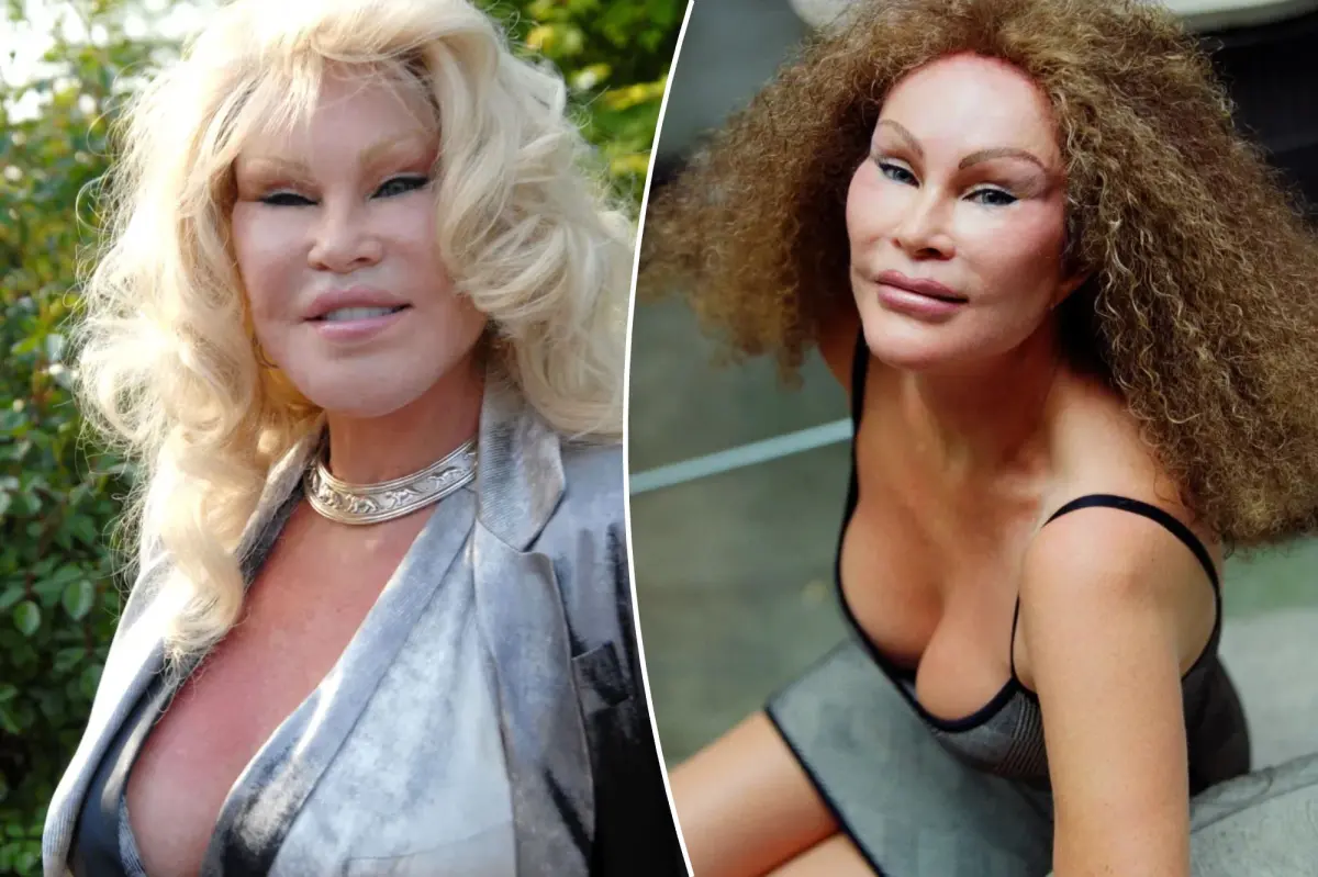 Jocelyn Wildenstein, famosa socialité conocida como la ‘Mujer Gato’, fallece pacíficamente a los 84 años